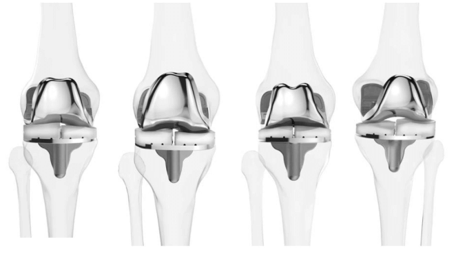 Εικόνα 4: Διαφορετικοί τύποι εμφυτευμάτων.