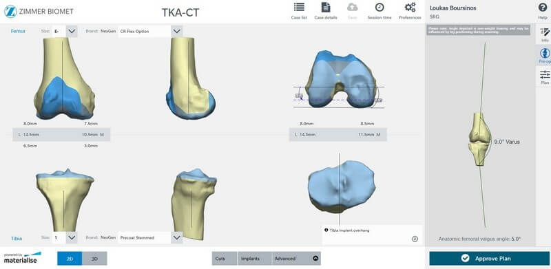 Εικόνα 5: Προεγχειρητικός σχεδιασμός χειρουργείου, υπολογισμός κλίσεων και στροφών με ακρίβεια χιλιοστού.